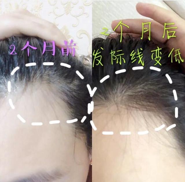 蜂花洗发水老款介绍（80后最爱的洗发水）(18)
