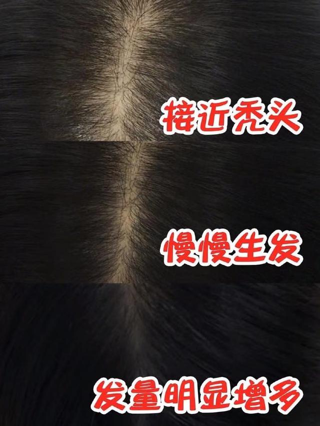 蜂花洗发水老款介绍（80后最爱的洗发水）(12)