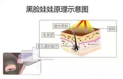 黑脸娃娃可以美白吗(今天是黑脸明天变白脸)(6)