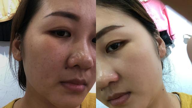 美白皮肤的方法6种美白的小妙招(学好3个美白方法)(2)