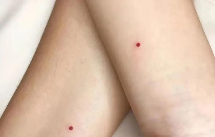 脸上朱砂痣的位置和命运