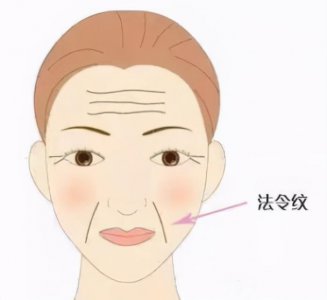 ​法令纹怎么形成的（法令纹是如何形成的）