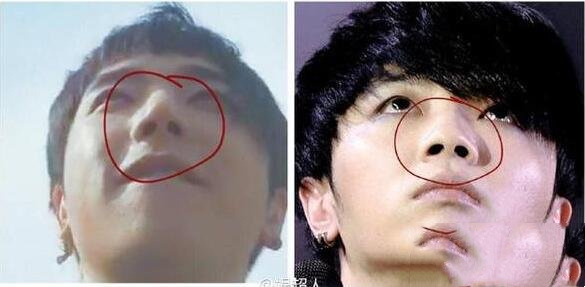 华晨宇整容前样子,整容后变成了权志龙惊悚