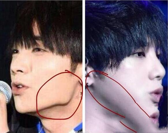 华晨宇整容前样子,整容后变成了权志龙惊悚