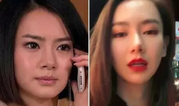 女星戚薇有没有整容,戚薇整容到底整哪里了