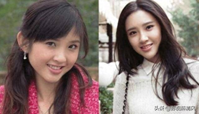 唐艺昕整容前有多好看?张若昀死心塌地爱了九年网友:不整早火了