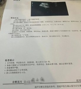 孕妇坐动车,怀胎7月的宝宝意外离世!刚刚通报来了