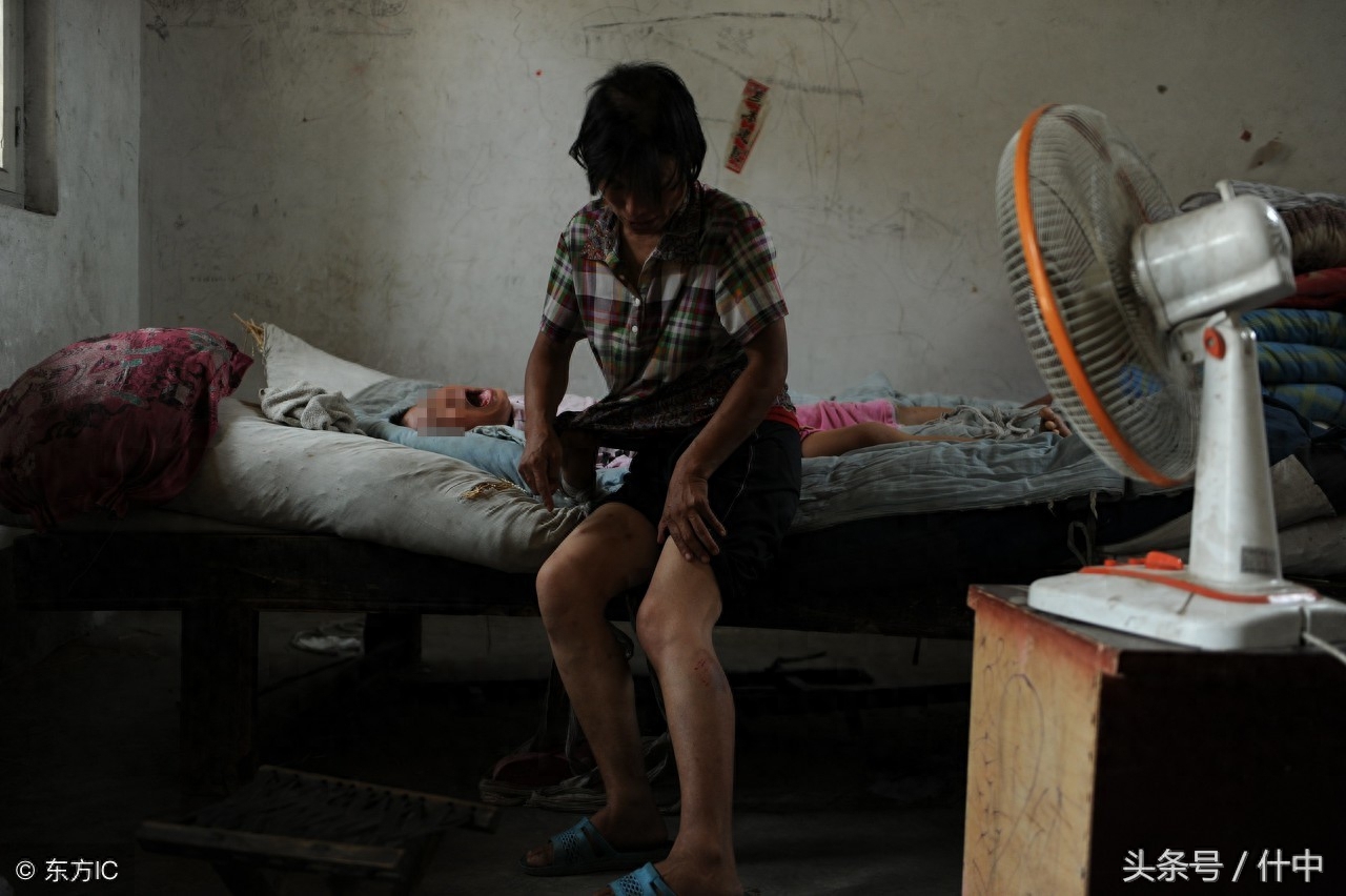 山东女孩患“狼人症”，见东西就咬且成天嘶吼，离婚母亲不离不弃