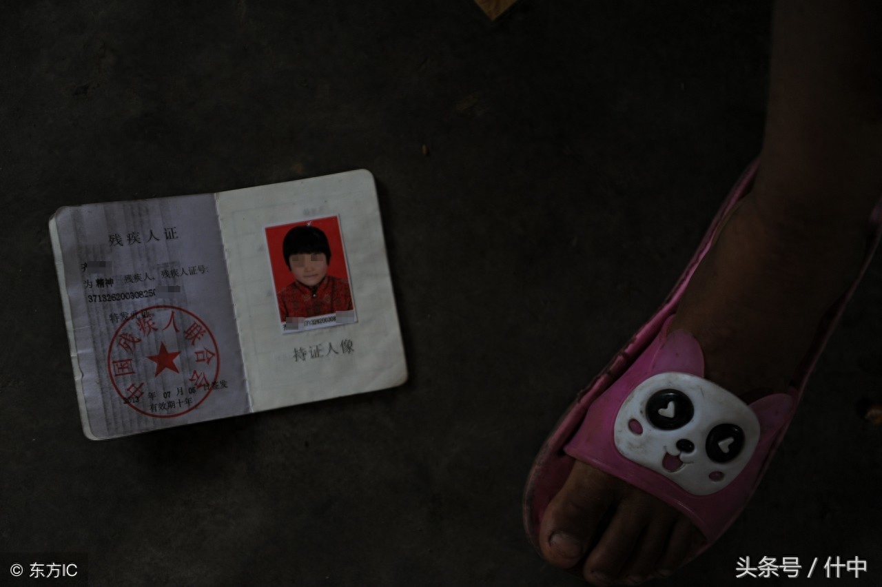 山东女孩患“狼人症”，见东西就咬且成天嘶吼，离婚母亲不离不弃