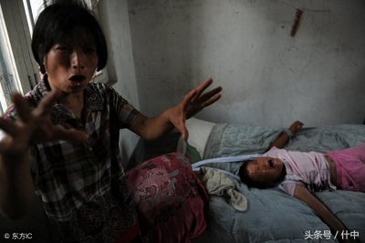 ​山东女孩患“狼人症”，见东西就咬且成天嘶吼，离婚母亲不离不弃