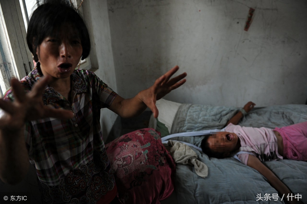 山东女孩患“狼人症”，见东西就咬且成天嘶吼，离婚母亲不离不弃