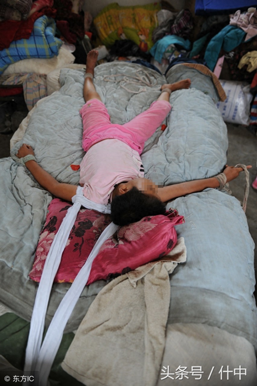 山东女孩患“狼人症”，见东西就咬且成天嘶吼，离婚母亲不离不弃