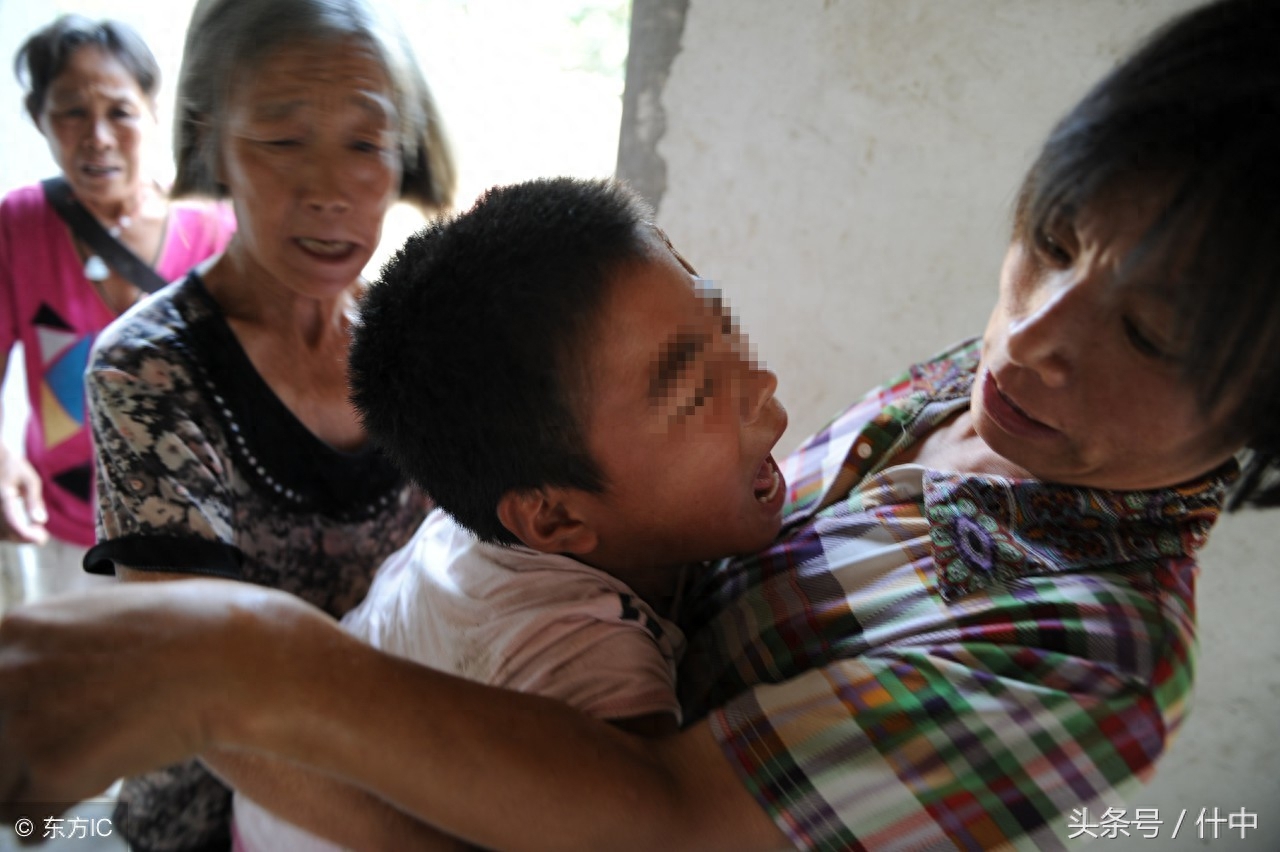 山东女孩患“狼人症”，见东西就咬且成天嘶吼，离婚母亲不离不弃