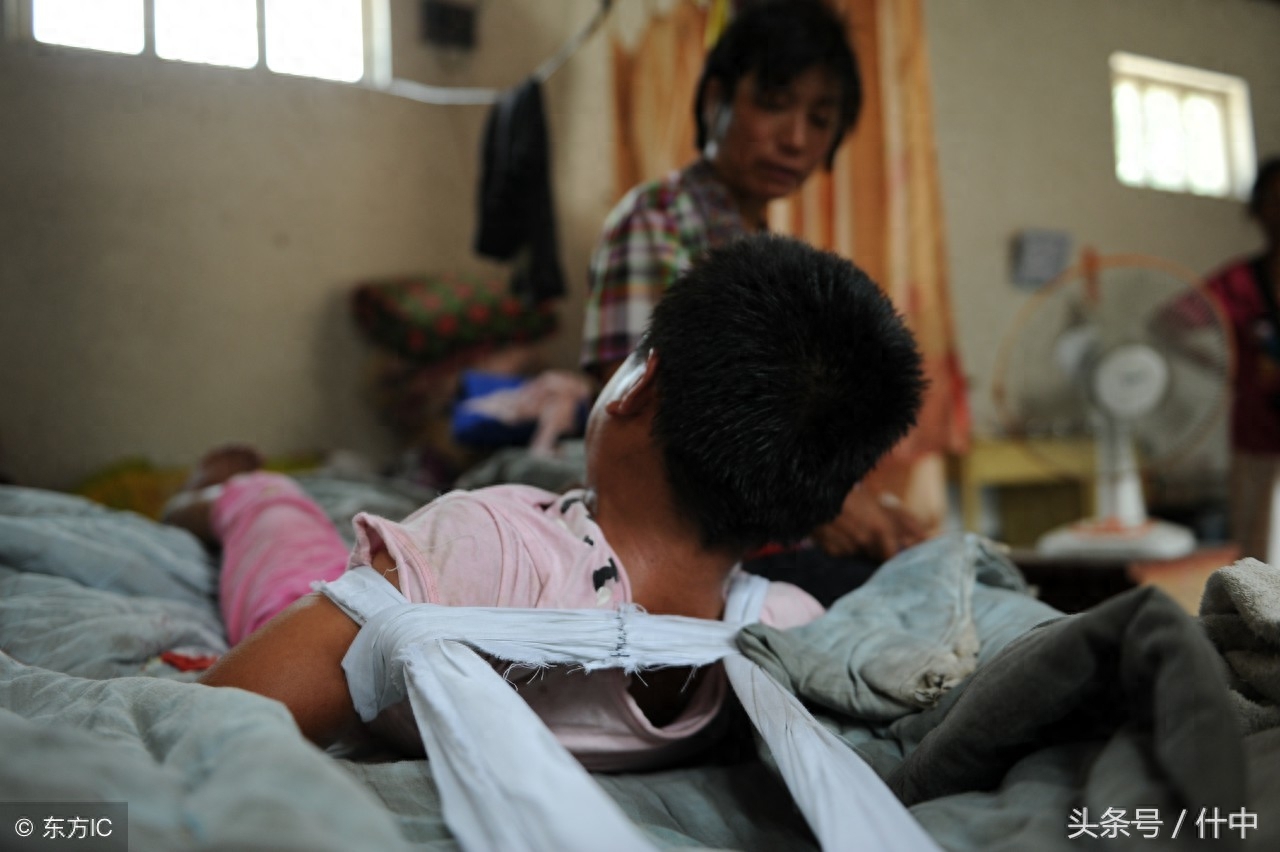 山东女孩患“狼人症”，见东西就咬且成天嘶吼，离婚母亲不离不弃