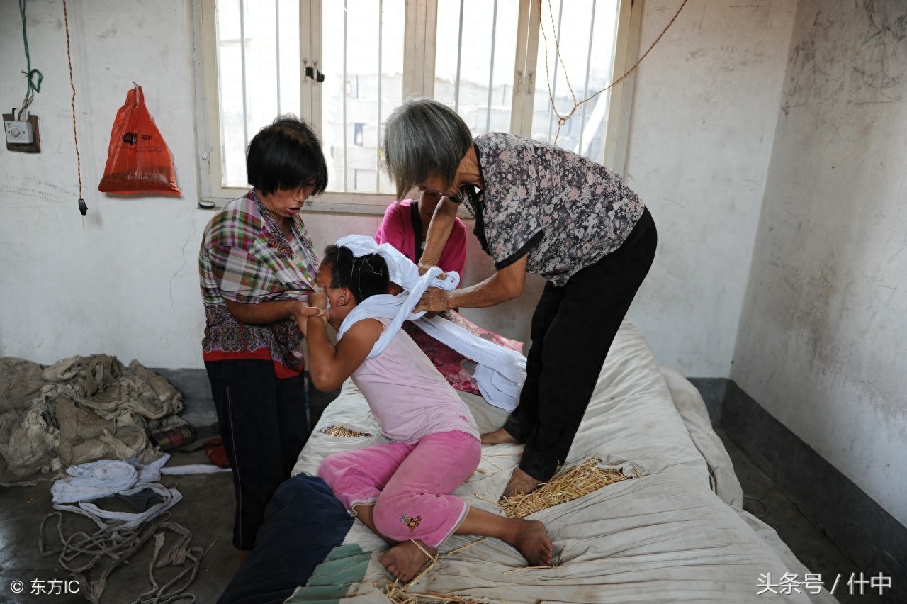 山东女孩患“狼人症”，见东西就咬且成天嘶吼，离婚母亲不离不弃